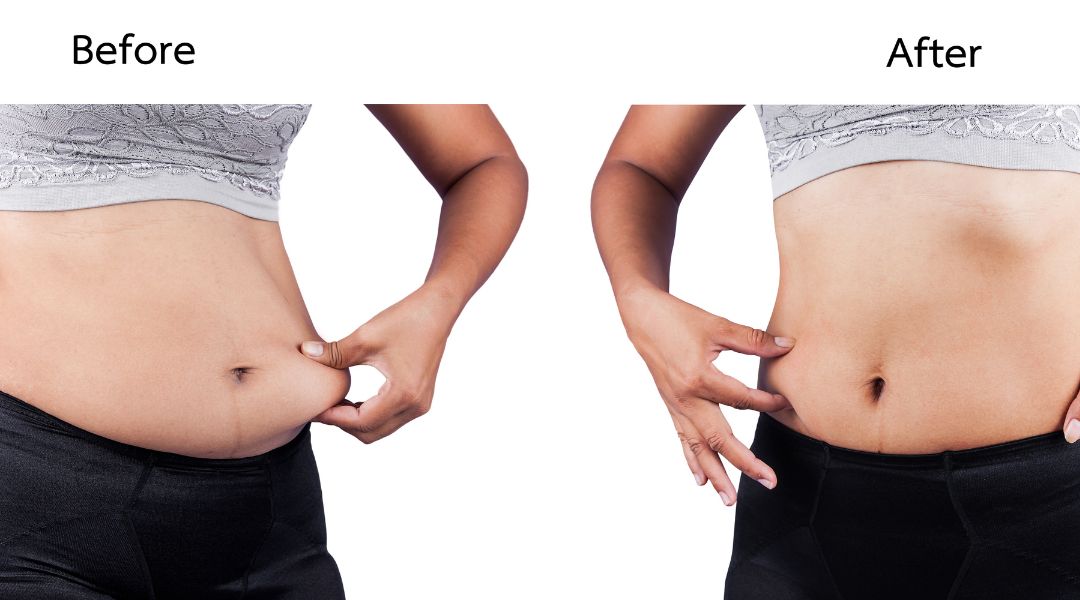5 Habits for Sustainable Weight Loss